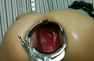 XXX წყვილი, ლამაზი